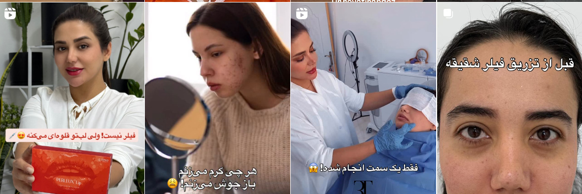 بهترین کلینیک و مرکز پاکسازی پوست در کرمانشاه(فیشیال)+ 1404