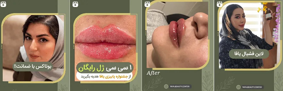 بهترین کلینیک و مرکز پاکسازی پوست در تبریز (فیشیال)+ 1404