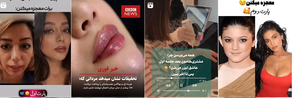 بهترین کلینیک و مرکز پاکسازی پوست در ارومیه(فیشیال)+ 1404