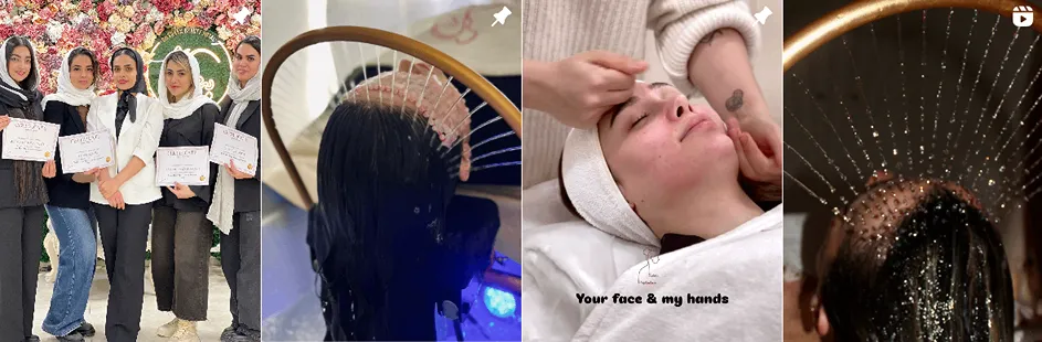 بهترین کلینیک و مرکز پاکسازی پوست در رشت (فیشیال)+ 1404