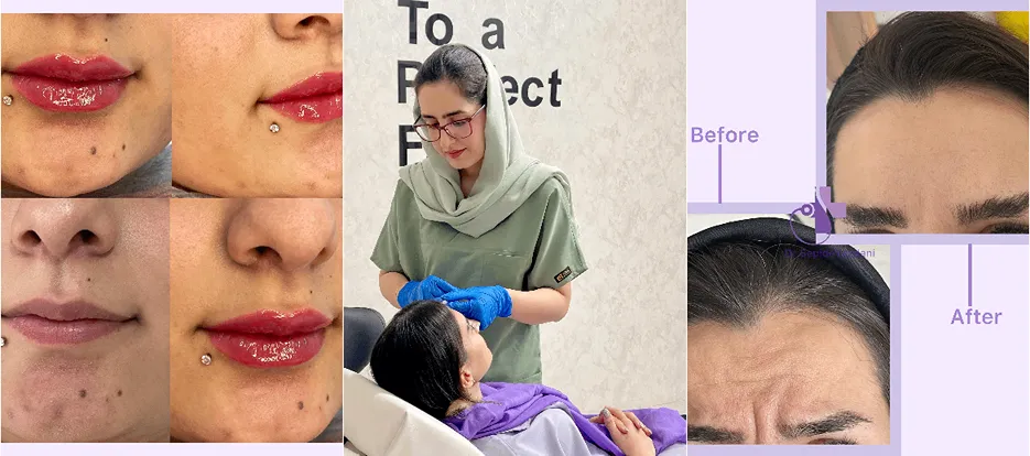 نمونه کار یکی از بهترین کلینیک لیزر در بیرجند را مشاهده میفرمایید.