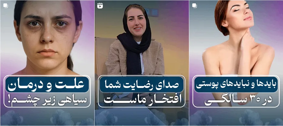 نمونه کار بهترین مرکز لیزر در یزد را مشاهده میفرمایید.