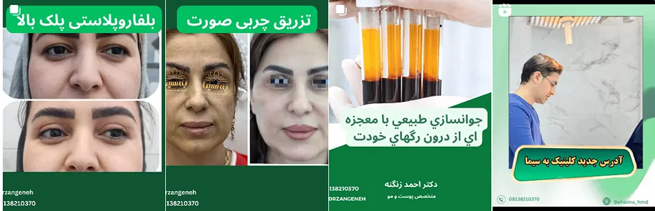 بهترین کلینیک و مرکز پاکسازی پوست در همدان (فیشیال)+ 1404