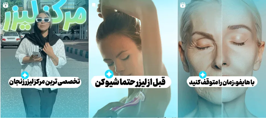 نمونه کار یکی از موثرترنی کلینیک لیزر زنجان را مشاهده میفرمایید.