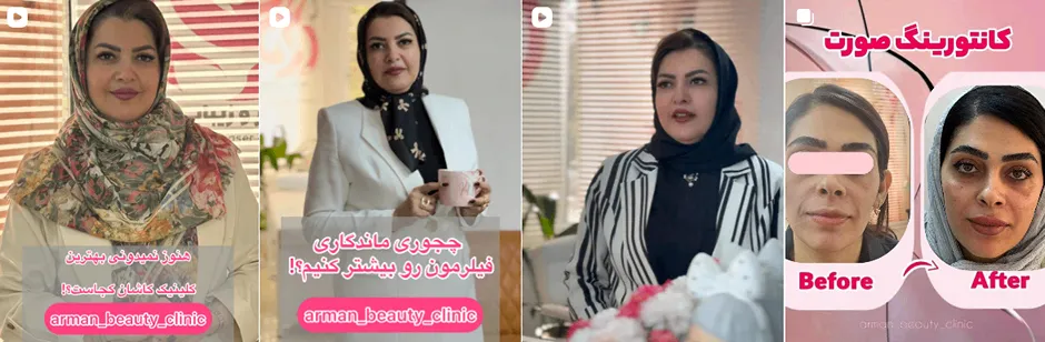 بهترین کلینیک و مرکز پاکسازی پوست در کاشان(فیشیال)+ 1404