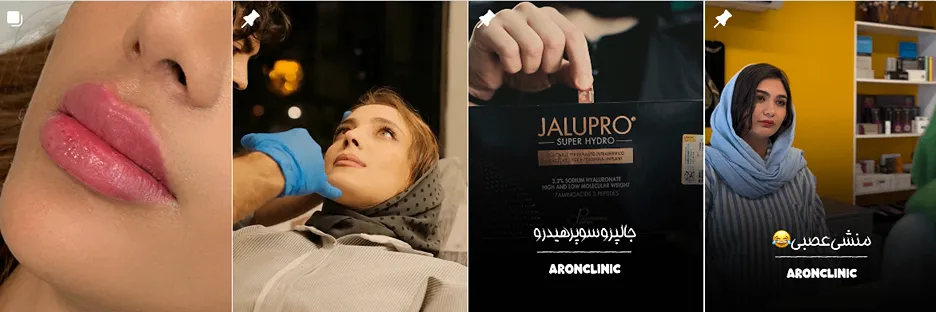 بهترین کلینیک و مرکز پاکسازی پوست در بجنورد(فیشیال)+ 1404