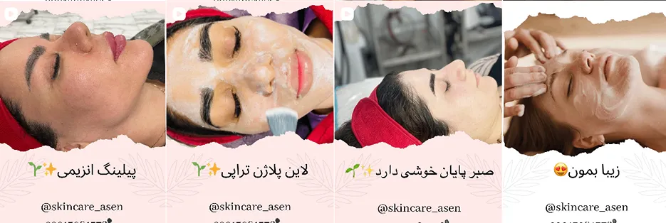 بهترین کلینیک و مرکز پاکسازی پوست در یاسوج (فیشیال)+ 1404