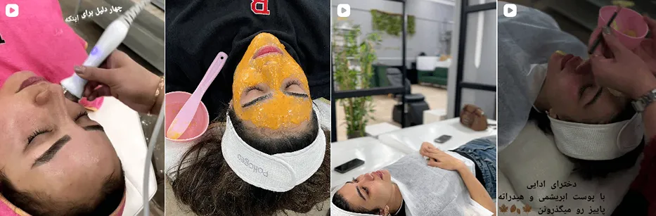 بهترین کلینیک و مرکز پاکسازی پوست در ایلام (فیشیال)+ 1404