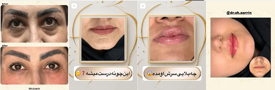 بهترین کلینیک و مرکز پاکسازی پوست در خرم آباد(فیشیال)+ 1404