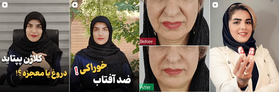 بهترین کلینیک و مرکز پاکسازی پوست در بیرجند(فیشیال)+ 1404