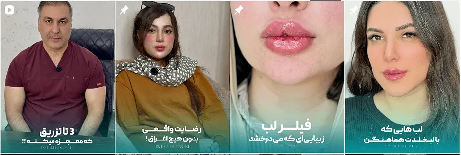 بهترین کلینیک و مرکز پاکسازی پوست در یاسوج (فیشیال)+ 1404