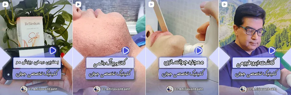 بهترین کلینیک و مرکز پاکسازی پوست در خرم آباد(فیشیال)+ 1404