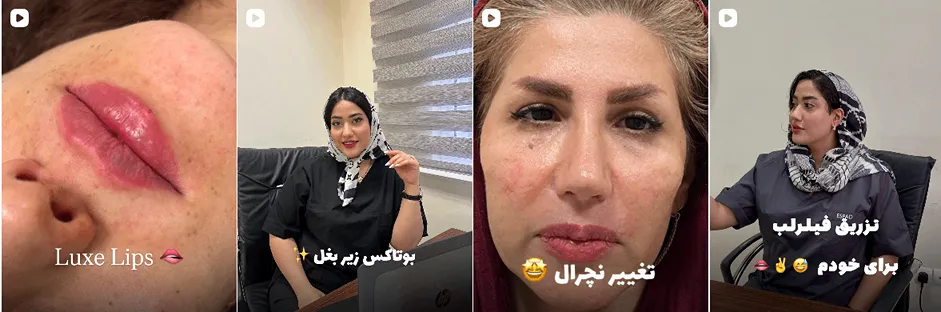 بهترین کلینیک و مرکز پاکسازی پوست در خرم آباد(فیشیال)+ 1404