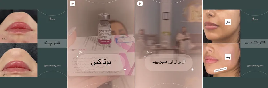 بهترین کلینیک و مرکز پاکسازی پوست در بجنورد(فیشیال)+ 1404