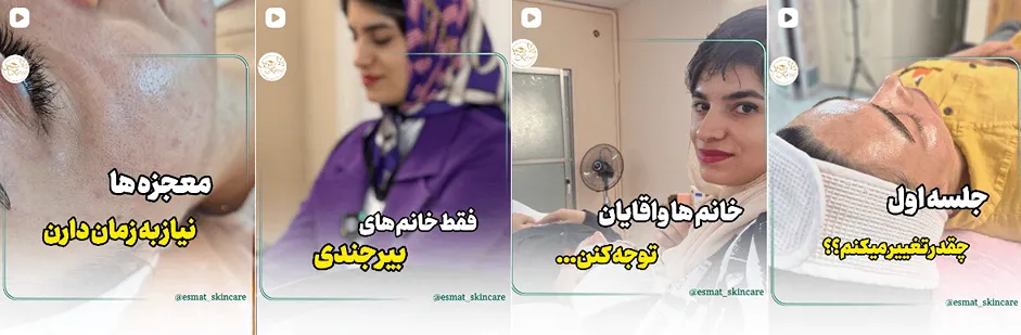 بهترین کلینیک و مرکز پاکسازی پوست در بیرجند(فیشیال)+ 1404