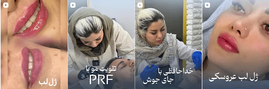 بهترین کلینیک و مرکز پاکسازی پوست در بجنورد(فیشیال)+ 1404