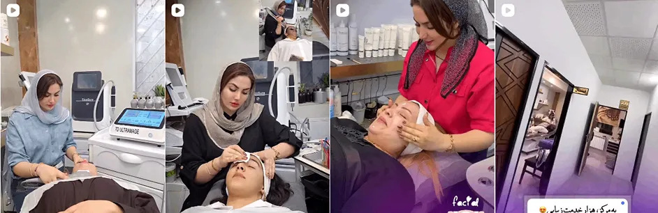 بهترین کلینیک و مرکز پاکسازی پوست در یاسوج (فیشیال)+ 1404