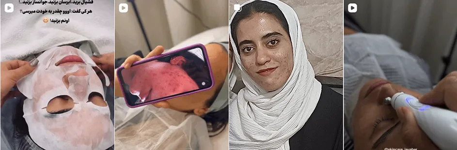 بهترین کلینیک و مرکز پاکسازی پوست در بیرجند(فیشیال)+ 1404