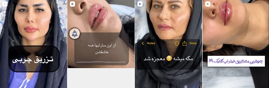 بهترین کلینیک و مرکز پاکسازی پوست در سنندج (فیشیال)+ 1404