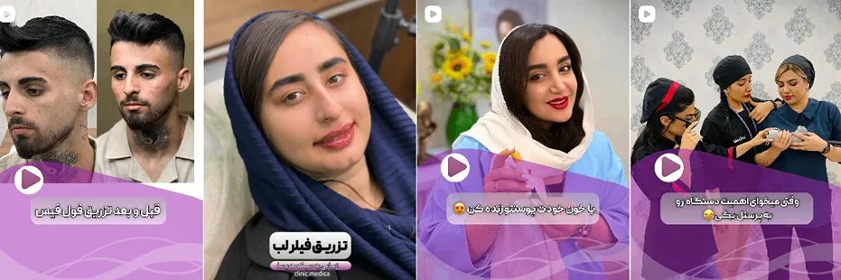 بهترین کلینیک و مرکز پاکسازی پوست در یاسوج (فیشیال)+ 1404