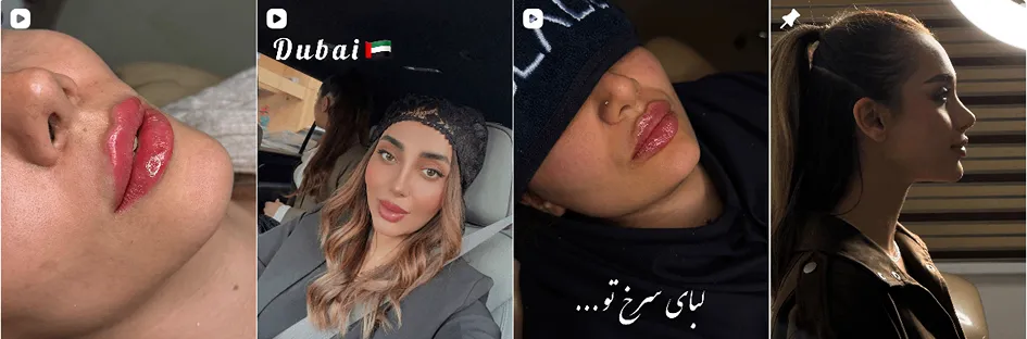 بهترین کلینیک و مرکز پاکسازی پوست در سمنان (فیشیال)+ 1404