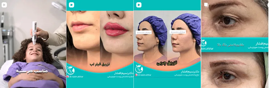 بهترین کلینیک و مرکز پاکسازی پوست در ایلام (فیشیال)+ 1404