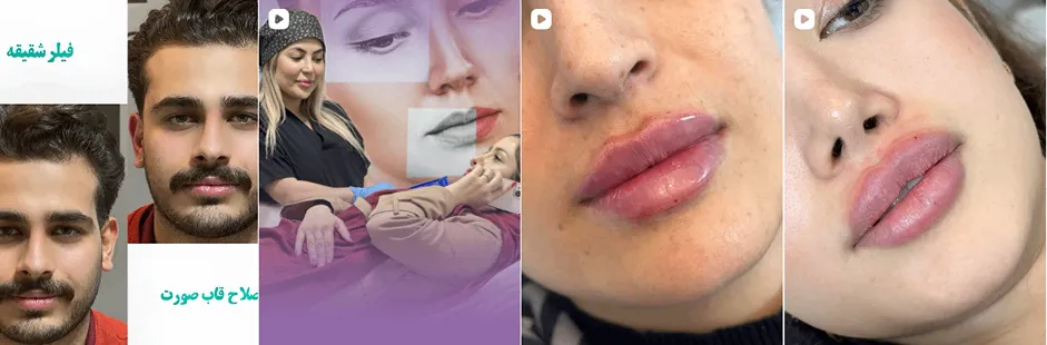 بهترین کلینیک و مرکز پاکسازی پوست در خرم آباد(فیشیال)+ 1404