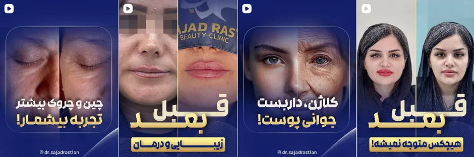 بهترین کلینیک و مرکز پاکسازی پوست در یاسوج (فیشیال)+ 1404