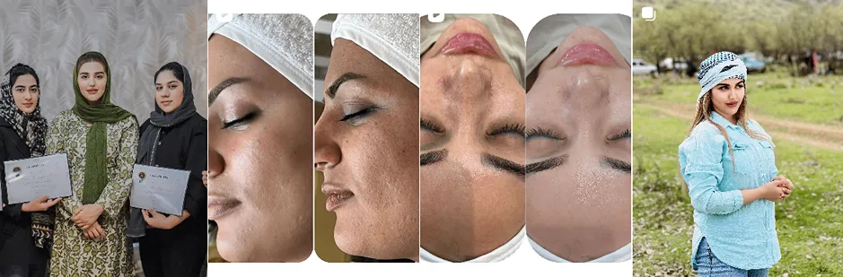 بهترین کلینیک و مرکز پاکسازی پوست در خرم آباد(فیشیال)+ 1404