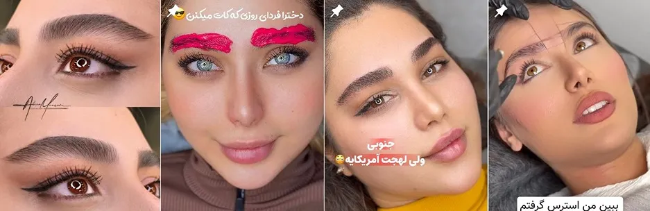 معرفی کامل بهترین مرکز شیدینگ لب در تهران 1404