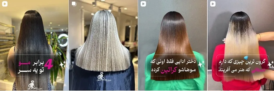 معرفی کامل بهترین مرکز بوتاکس مو در تهران 1404