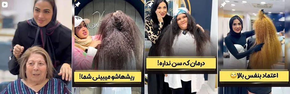 معرفی کامل بهترین مرکز بوتاکس مو در تهران 1404