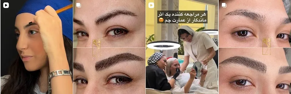 معرفی کامل بهترین مرکز میکروبلیدینگ ابرو در تهران 1404