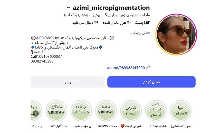 معرفی کامل بهترین مرکز شیدینگ لب در تهران 1404
