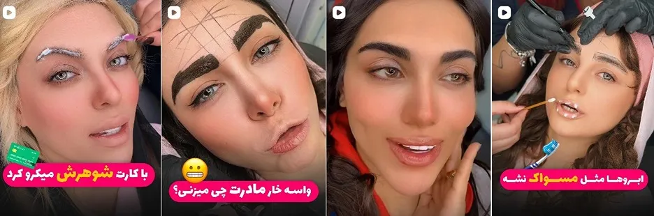 معرفی کامل بهترین مرکز فیبروز ابرو در تهران 1404