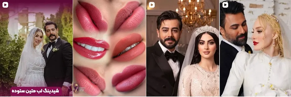 معرفی کامل بهترین مرکز شیدینگ لب در تهران 1404