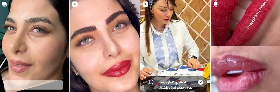 معرفی کامل بهترین مرکز میکروبلیدینگ ابرو در تهران 1404