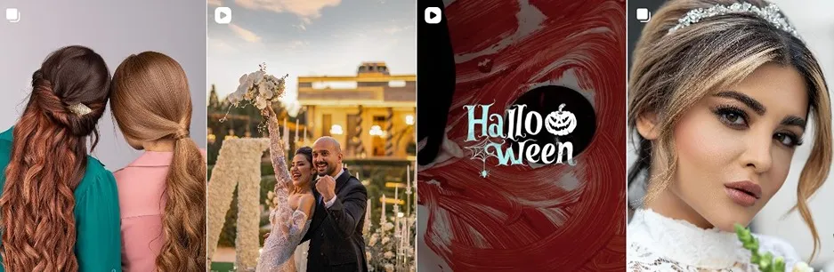 معرفی کامل بهترین مراکز بافت مو در تهران 1404