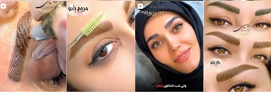 معرفی کامل بهترین مرکز فیبروز ابرو در تهران 1404