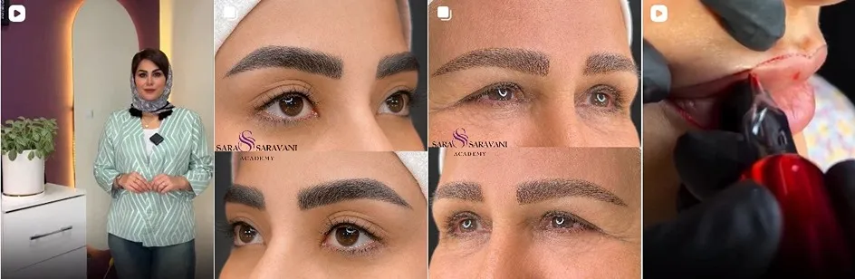 معرفی کامل بهترین مرکز شیدینگ لب در تهران 1404