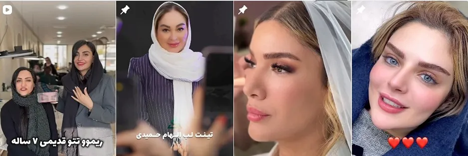 معرفی کامل بهترین مرکز شیدینگ لب در تهران 1404