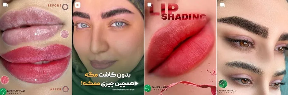 معرفی کامل بهترین مرکز شیدینگ لب در تهران 1404