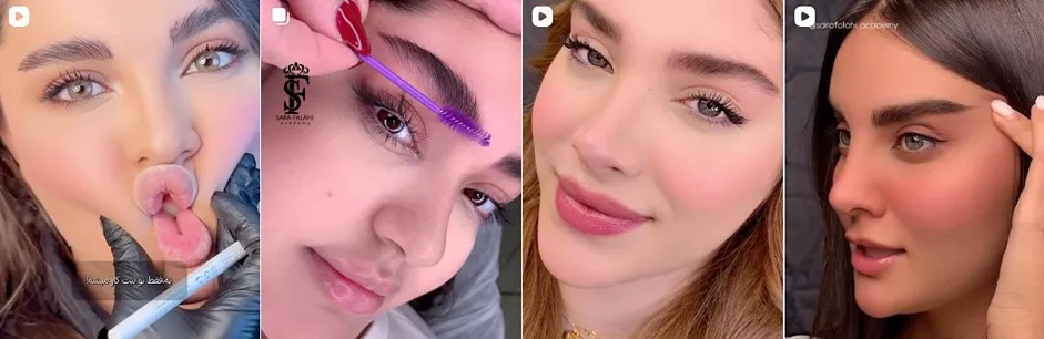 معرفی کامل بهترین مرکز فیبروز ابرو در تهران 1404