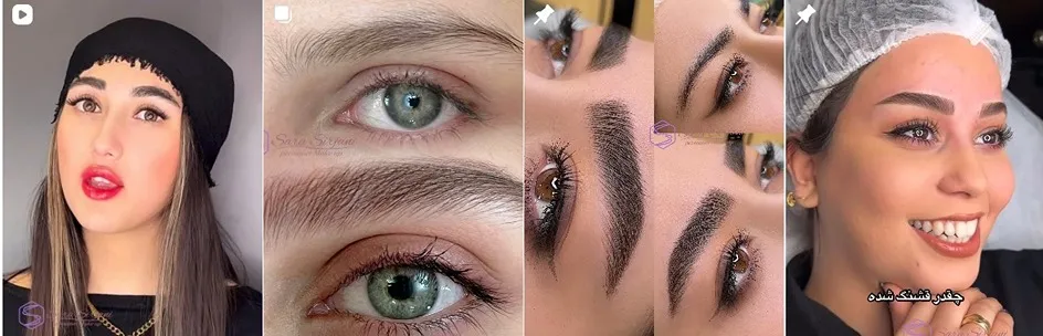 معرفی کامل بهترین مرکز میکروبلیدینگ ابرو در تهران 1404