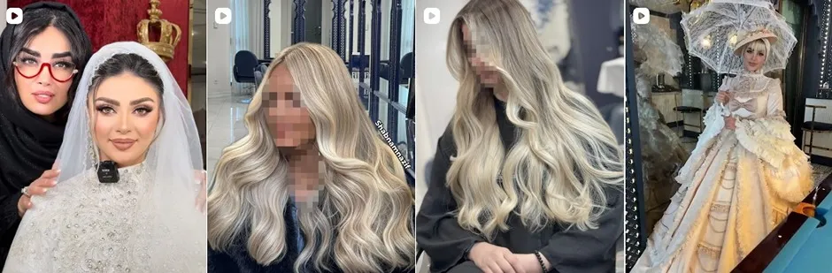 معرفی کامل بهترین مرکز بوتاکس مو در تهران 1404