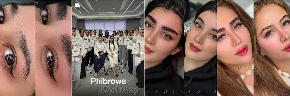 معرفی کامل بهترین مرکز شیدینگ لب در تهران 1404