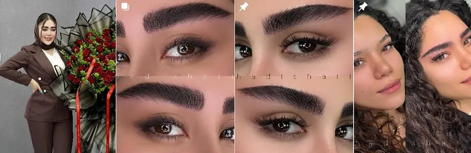 معرفی کامل بهترین مرکز فیبروز ابرو در تهران 1404